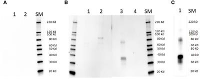 A conserved motif in the immune-subdominant RAP-1 related antigen of Babesia bovis contains a B-cell epitope recognized by antibodies from protected cattle